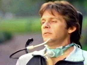 Gary Cole after the accident in The Switch
